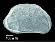 貝形虫化石の電子顕微鏡写真